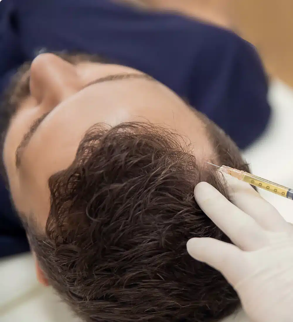 male-hair-restoration-injections