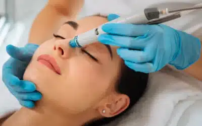HydraFacial for Acne: A Quick Answer to Clear Skin!