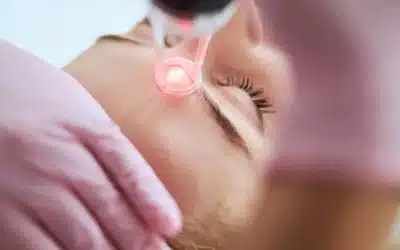BBL vs. MOXI: Which Laser Treatment Is Right for Your Skin Concerns?