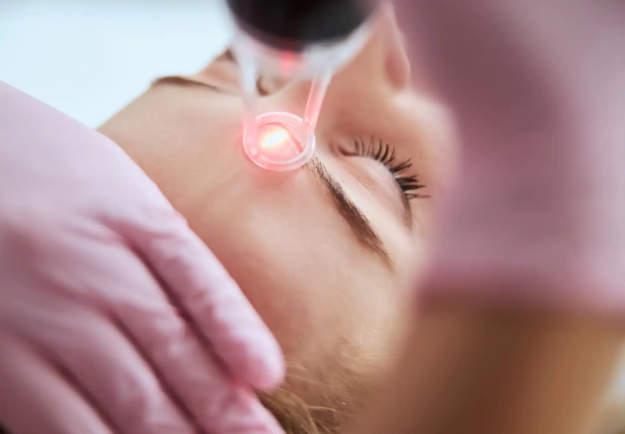 Sculptra in Baltimore, MD.
