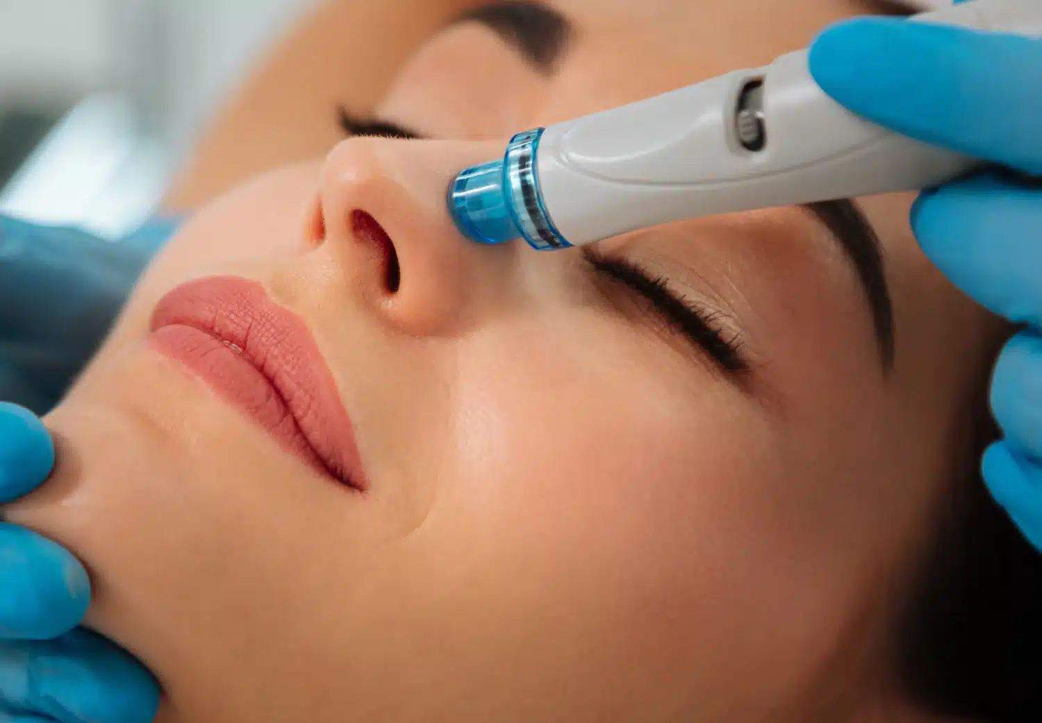 Sculptra in Baltimore, MD.